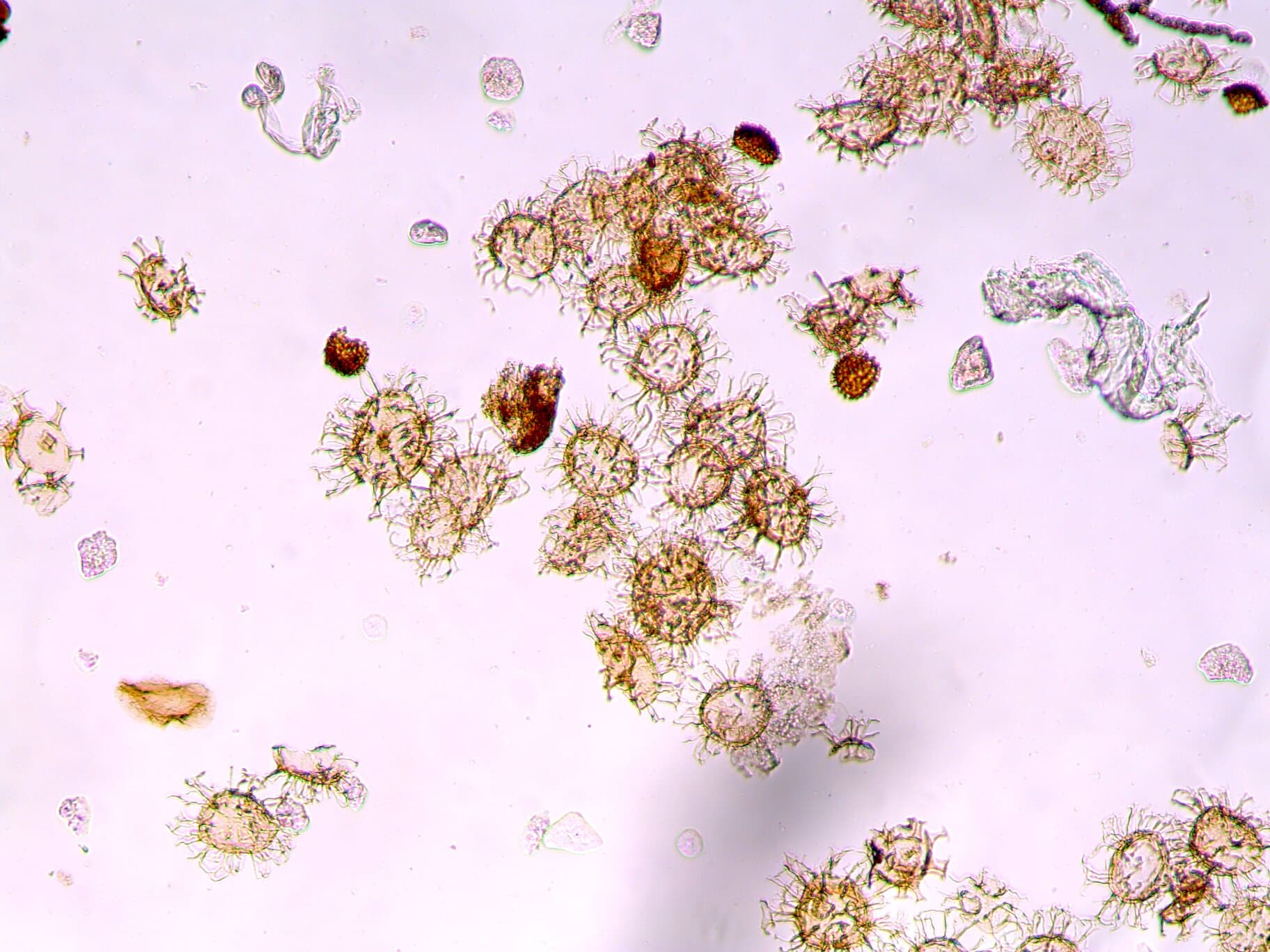 Past climate change: First indicators show resilience in tropical life—up to 1.5°C - Phys.org