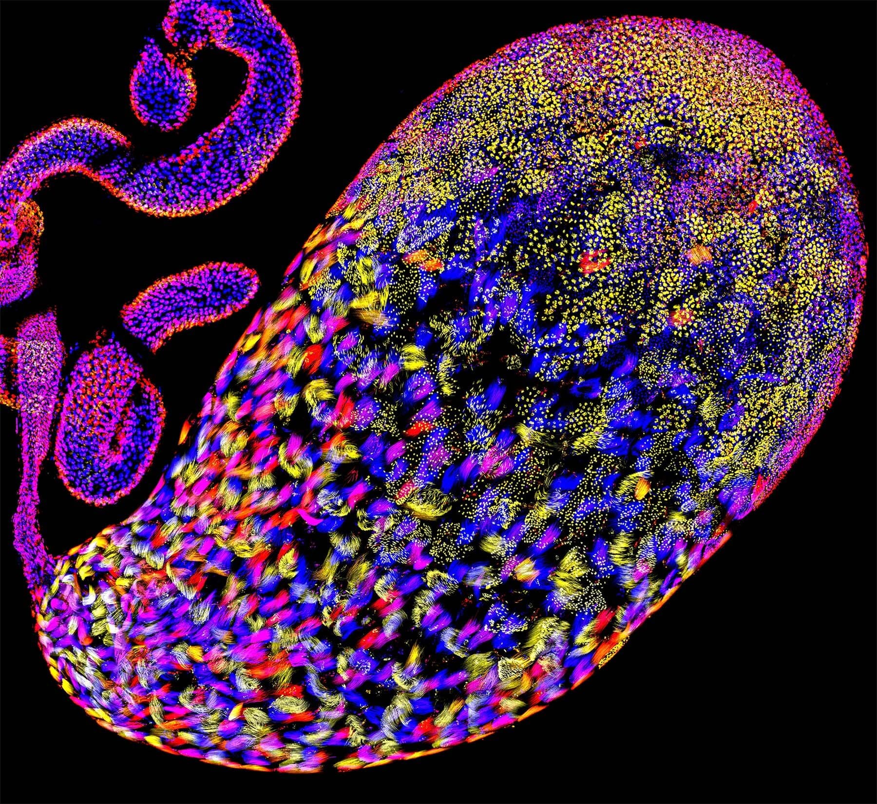 Selfish sperm hijack Overdrive gene to kill healthy rivals