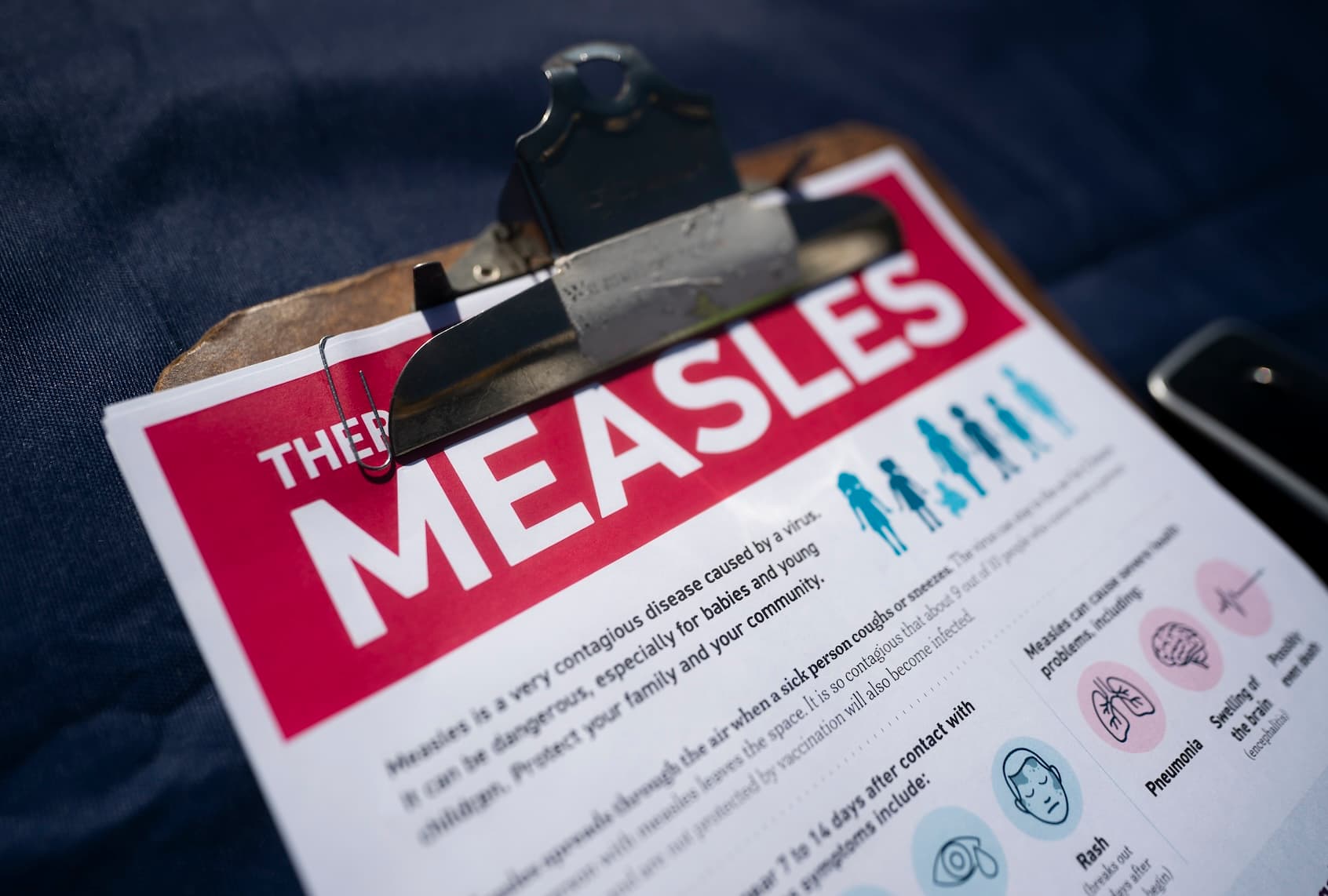 Measles Outbreaks Surge: U.S. On Track to Surpass Worst Year Since 1991 as Anti-Vaccine Sentiment Rises