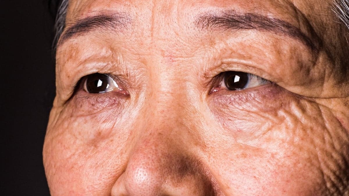 Vision Tests May Detect Dementia Risk 12 Years Early: New Studies Reveal Critical Link