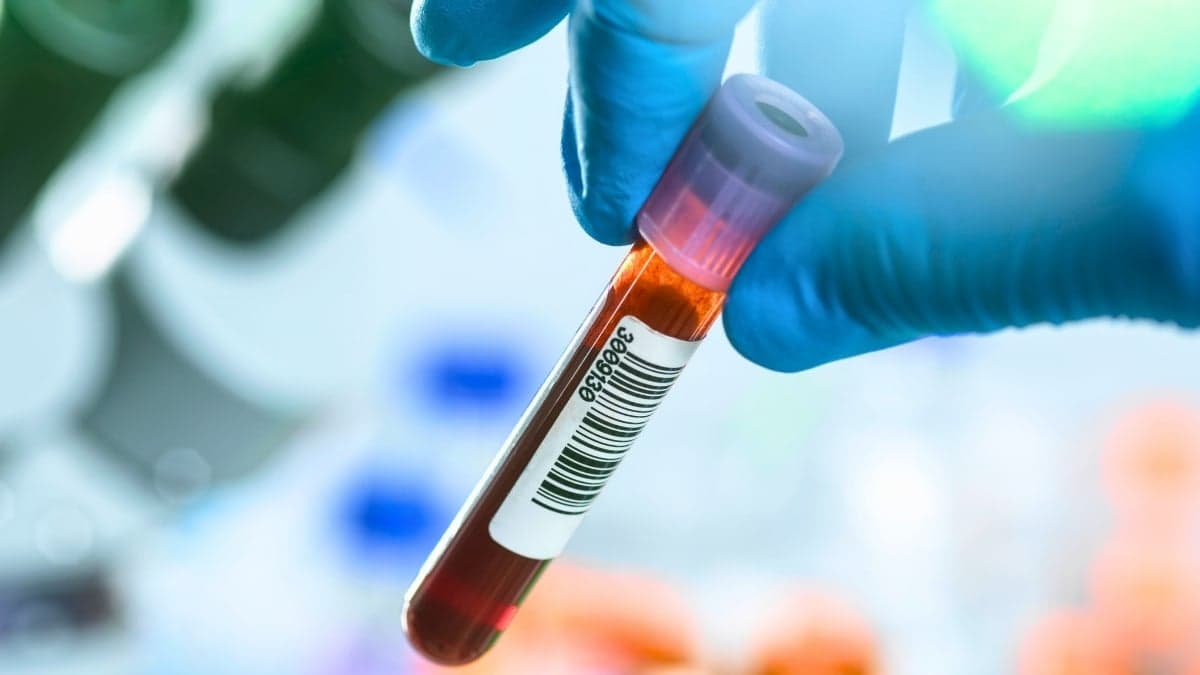 Blood Tests Could Revolutionize Early Cancer Detection – But There's a Catch - ScienceAlert