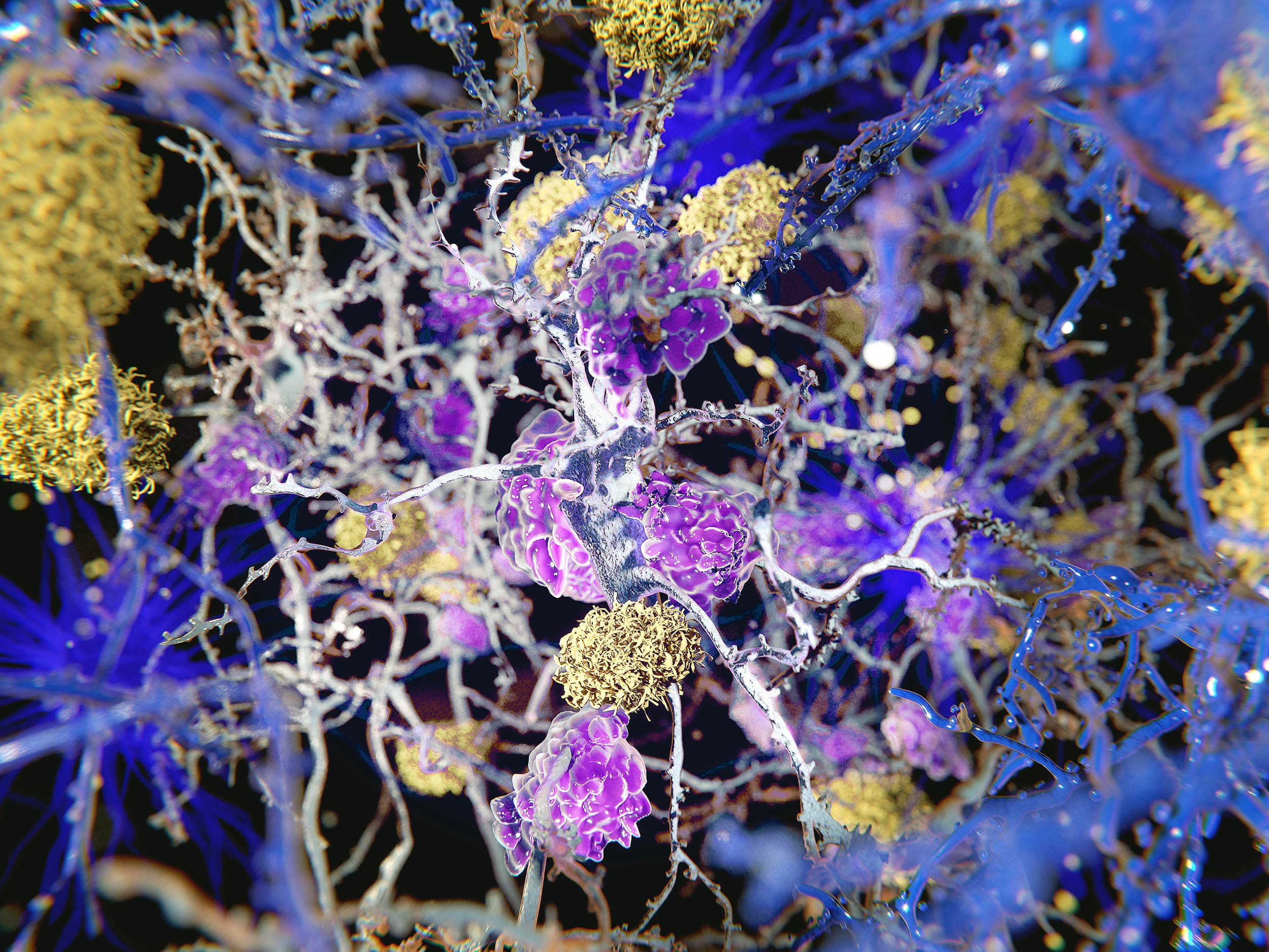 Groundbreaking Study Suggests Alzheimer’s Starts with Systemic Inflammation Beyond the Brain