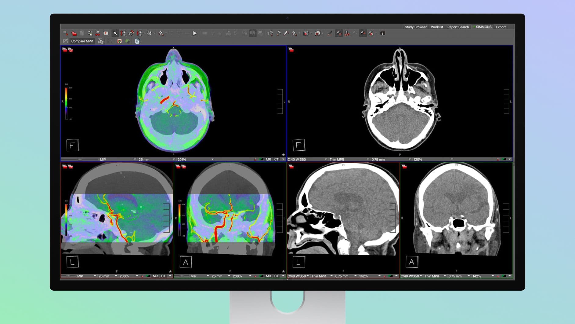 Apple's Studio Display XDR Supports DICOM Medical Imaging for Diagnostic Radiology - MacRumors