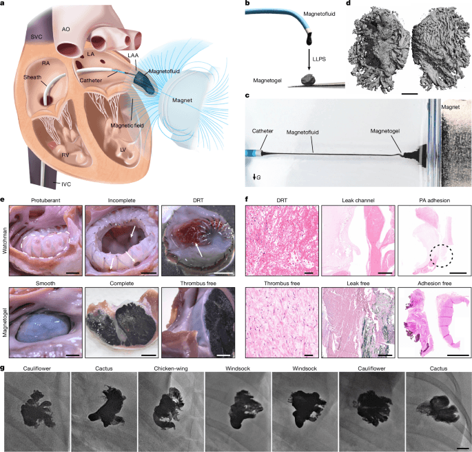 Long-term thrombus-free left atrial appendage occlusion via magnetofluids - Nature