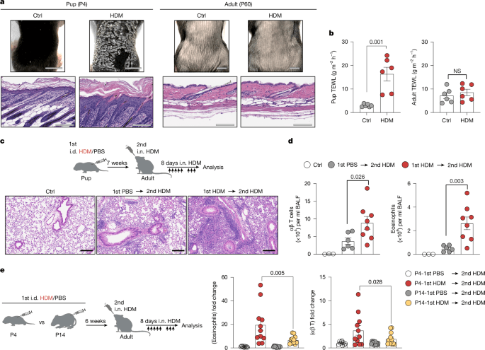 Peripheral immune-inducer dendritic cells drive early-life allergic inflammation - Nature