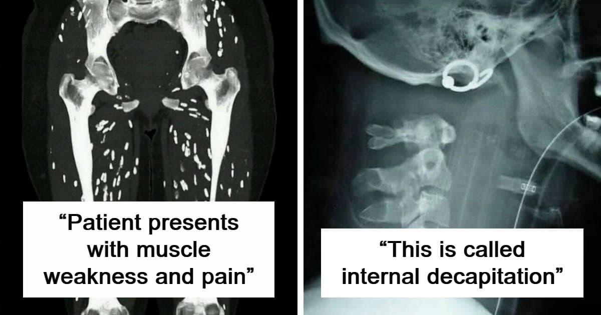 “Green Hairy Tongue!”: These 41 Medical Images Should Be Viewed With Caution (New Pics)