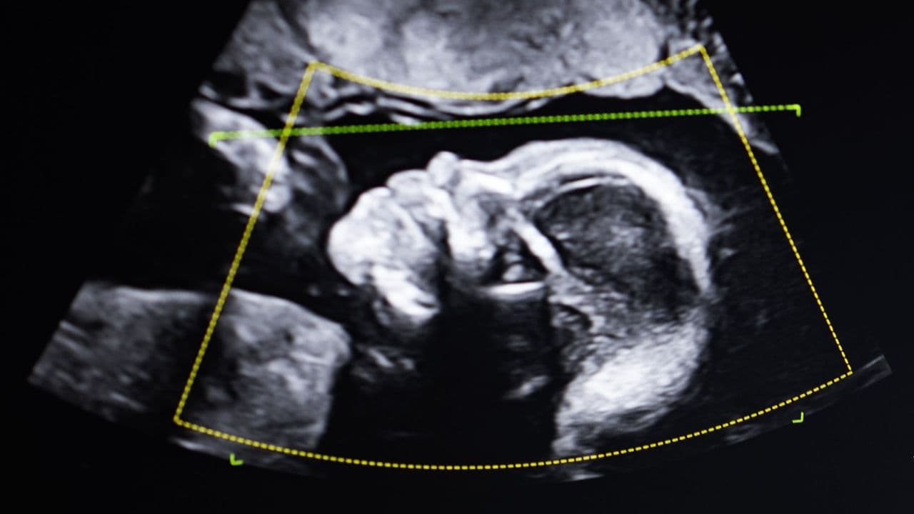 'It doesn't lie. So who are you?': What happens when DNA tests show a woman is not the mother of the child she gave birth to?