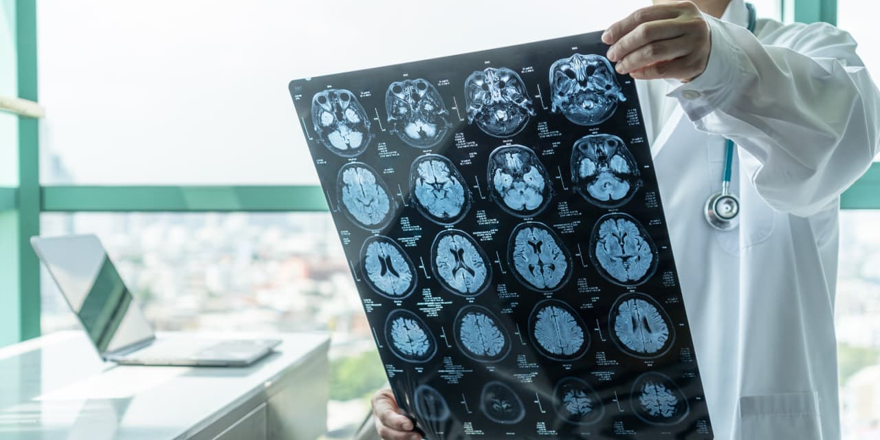 There’s a vital difference in how Medicare and Medicare Advantage prevent and treat strokes. What you should know. - MarketWatch