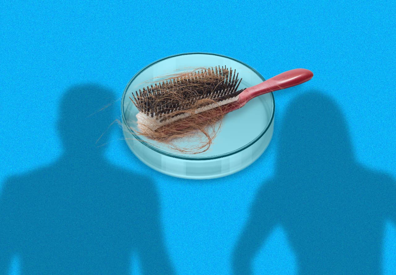 For the first time in decades, new hair-loss treatments are in the works. Here’s how they’re different.