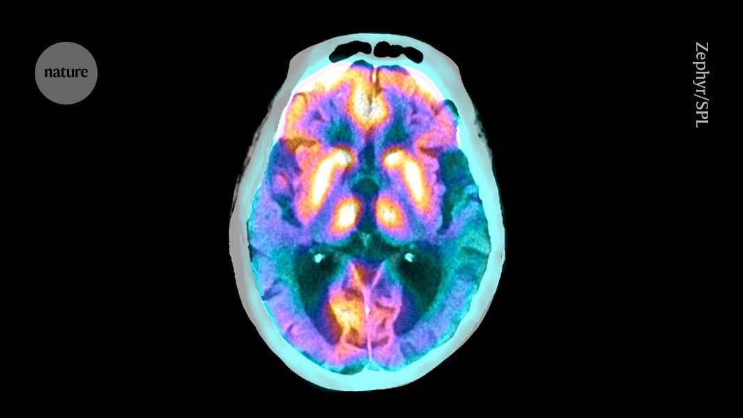 These brain cells clear proteins that contribute to Alzheimer’s - Nature