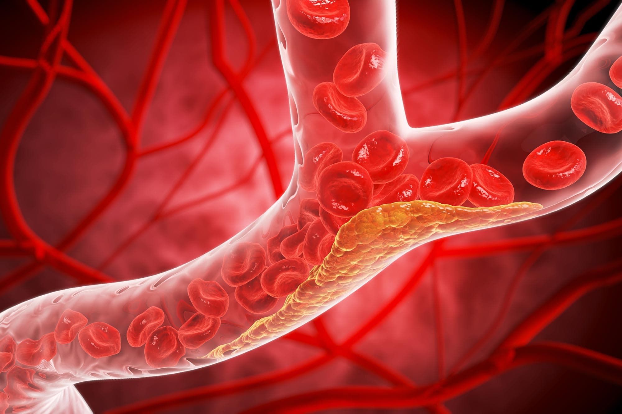 Experimental Oral PCSK9 Inhibitor Slashes 'Bad' Cholesterol by 60% in Landmark Trial
