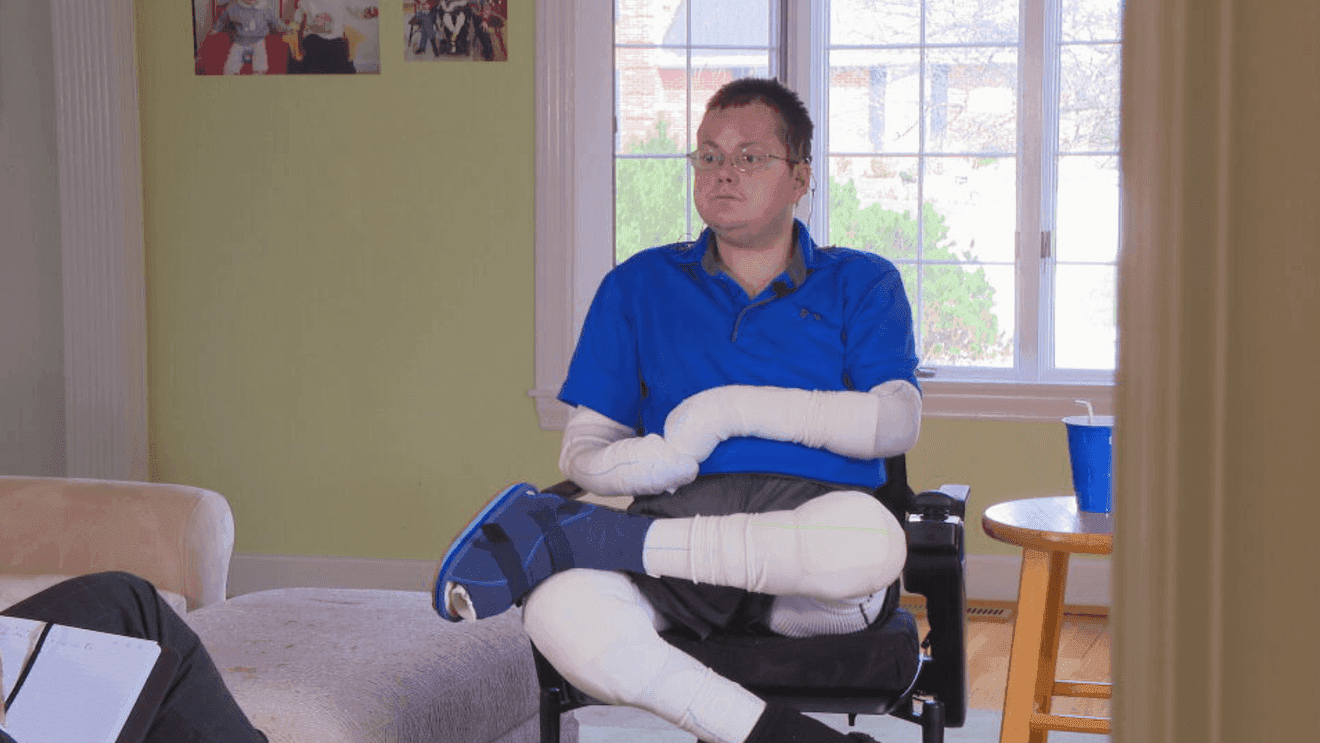 Local 'Butterfly Syndrome' survivor works to aid those with rare genetic disorder