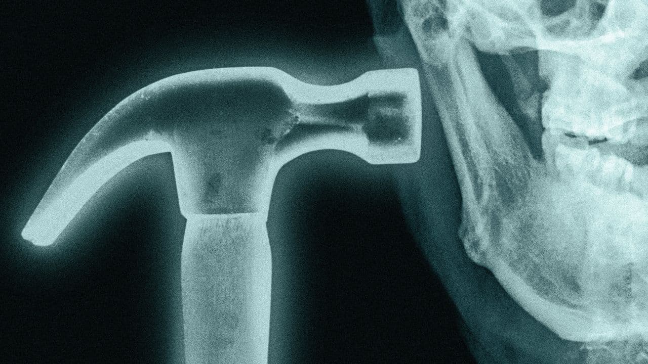 What is Bonesmashing? Inside the Extreme Looksmaxxer Technique - GQ