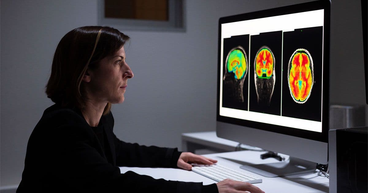 AI-Powered MRI Analysis Detects Early Alzheimer’s with 93% Accuracy by Identifying Brain Volume Loss Patterns