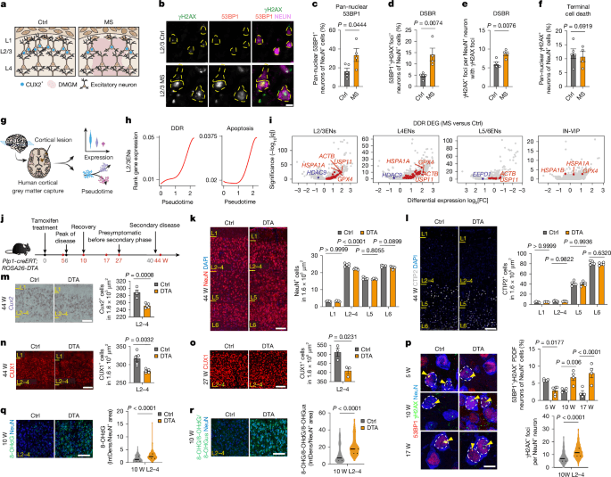 New Study Reveals How DNA Damage Drives Selective Brain Cell Loss in Multiple Sclerosis