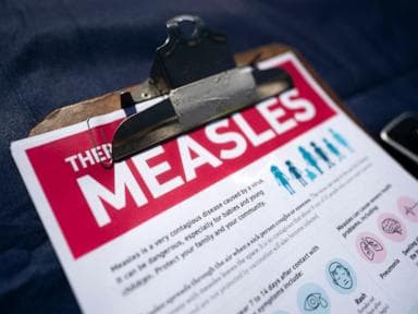 US surpasses 1,000 measles cases for the 3rd time in 26 years, CDC data shows
